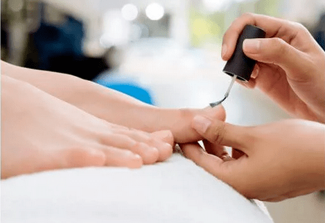 Μύγα βερνίκια