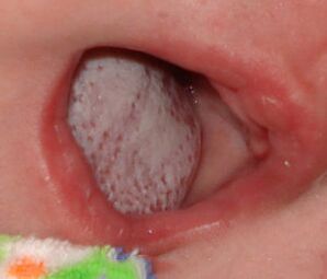 Εντοπισμός της νόσου με μύκητα